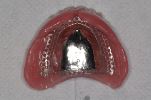作成した義歯の写真